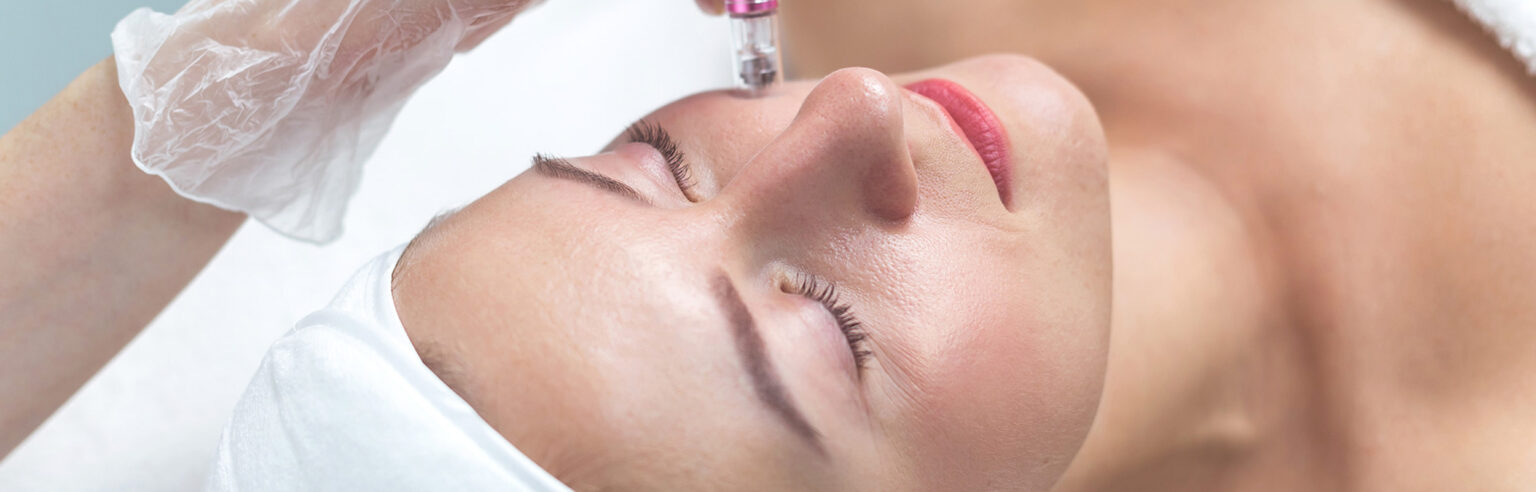 microneedling fonctionnement